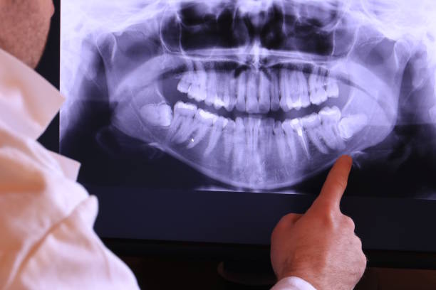 Best Emergency Dental Care for Trauma or Injury in Turnersville, NJ